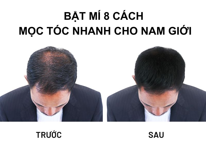 moc-toc-nhanh